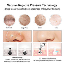 Load image into Gallery viewer, Household Electric Blackhead Dirt Removal Machine, Household Vacuum Suction Wrinkle Removal Skin Tightening Massager with 4 Suction Heads