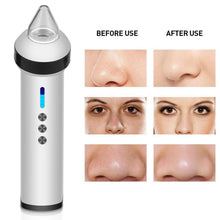 Load image into Gallery viewer, Household Electric Blackhead Dirt Removal Machine, Household Vacuum Suction Wrinkle Removal Skin Tightening Massager with 4 Suction Heads
