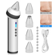 Household Electric Blackhead Dirt Removal Machine, Household Vacuum Suction Wrinkle Removal Skin Tightening Massager with 4 Suction Heads